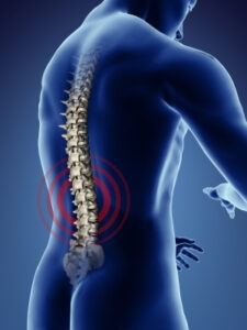 Post Spinal Surgery Pain Post-Laminectomy Pain